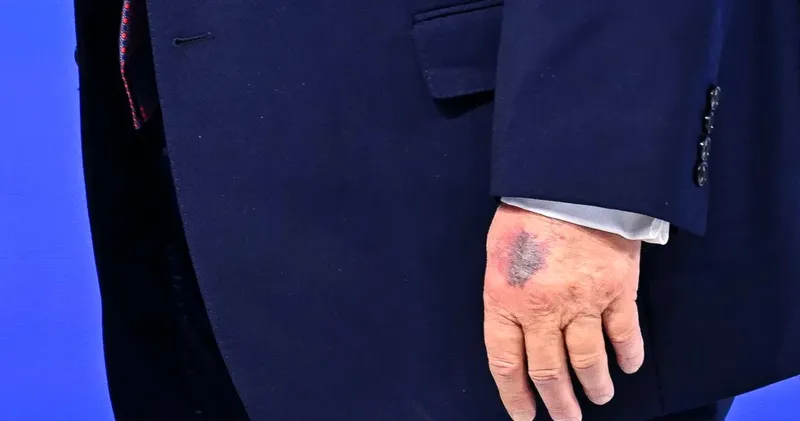 Starea de sănătate a lui Trump atrage din nou atenția